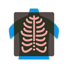 X-Ray